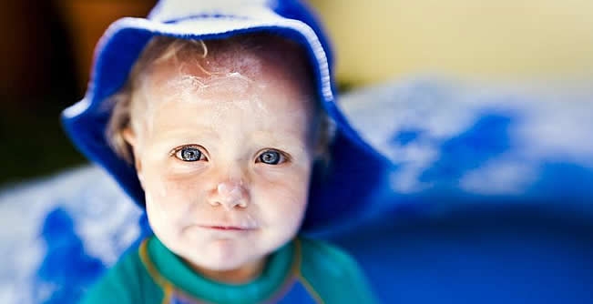 Charity seeks 100,000 signatures in bid to stop child sunburn in English schools