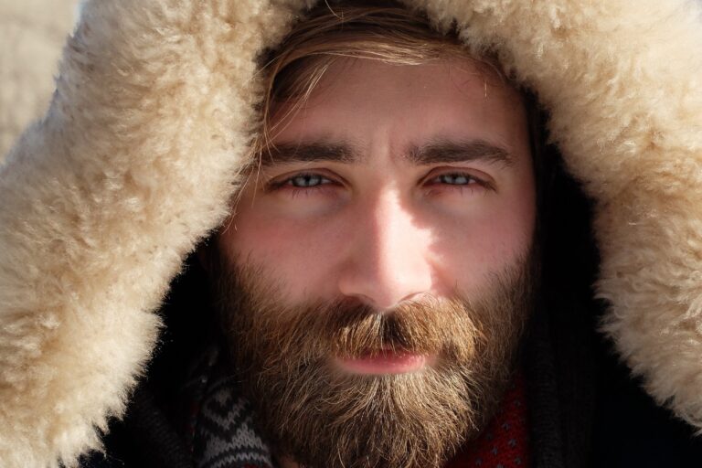 7 essential remedies for your patchy beard